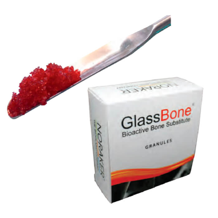 Ecucomed-Equipos-e-Instrumental-medico-en-Quito-Ecuador-GLASSBONE-GRANULES